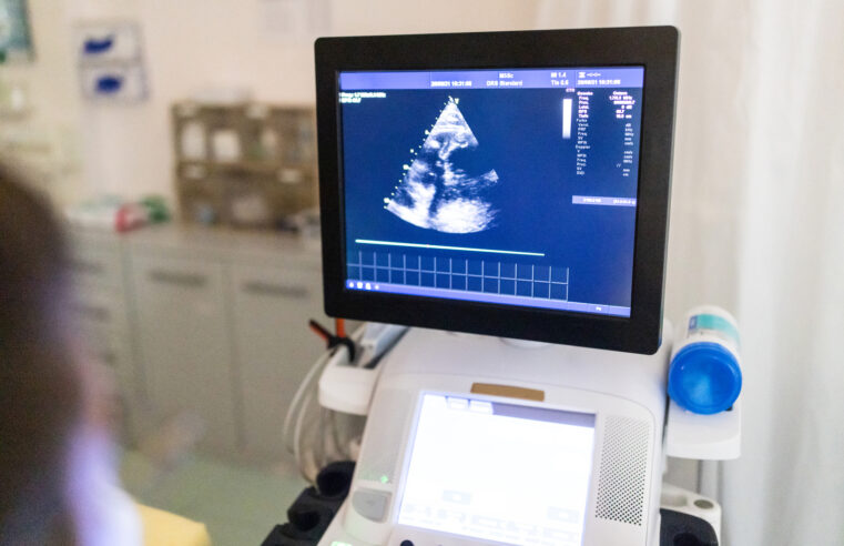 How Hypertrophic Cardiomyopathy Is Diagnosed